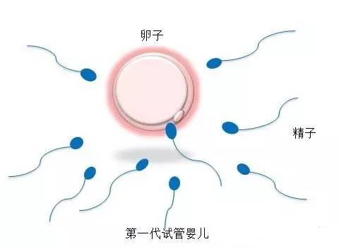 遗传咨询